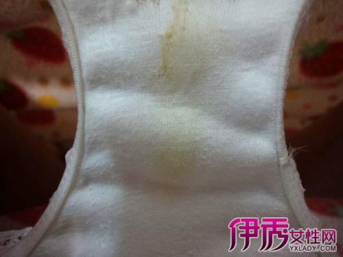 白帶發(fā)黃能自愈嗎？解讀白帶異常與自我調(diào)理方法，白帶發(fā)黃能否自愈？解讀白帶異常及自我調(diào)理策略