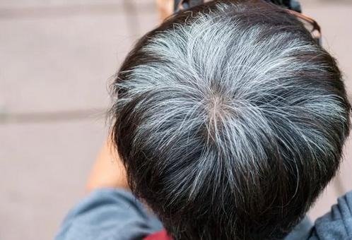 葉酸能讓白頭發(fā)變黑嗎，探究真相與科學(xué)理解，葉酸能否讓白頭發(fā)變黑？真相與科學(xué)解析