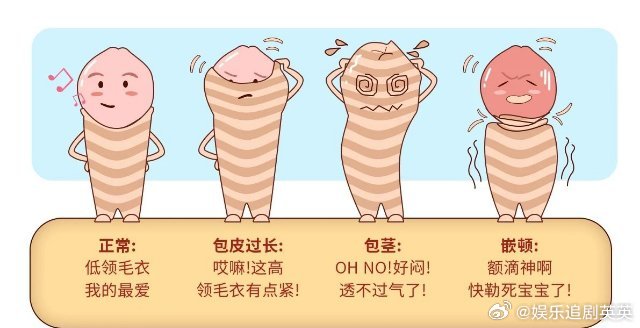 為什么當(dāng)兵要割包皮，探討男性割包皮與軍事服役的相關(guān)性，男性割包皮與軍事服役的相關(guān)性探討，為何當(dāng)兵需考慮割包皮？