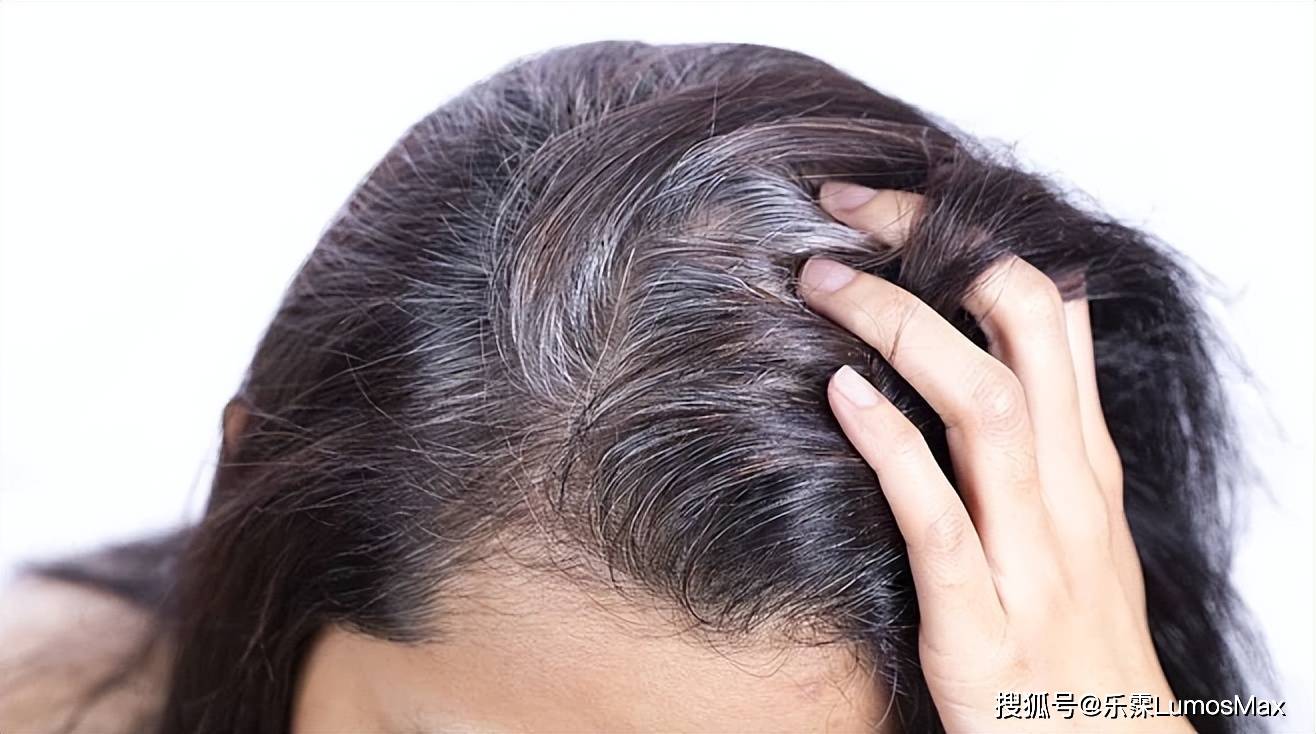 白發(fā)變黑發(fā)最快土法——自然恢復(fù)黑發(fā)的秘訣，自然黑發(fā)秘訣，白發(fā)變黑發(fā)最快土法攻略