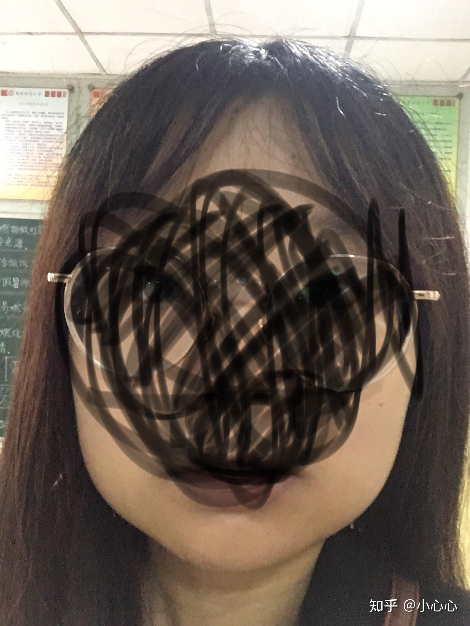 拔智齒會(huì)改變臉型嗎？——深度解析智齒拔除與臉型變化關(guān)系，拔智齒會(huì)影響臉型嗎？——智齒拔除與臉型變化的深度解析