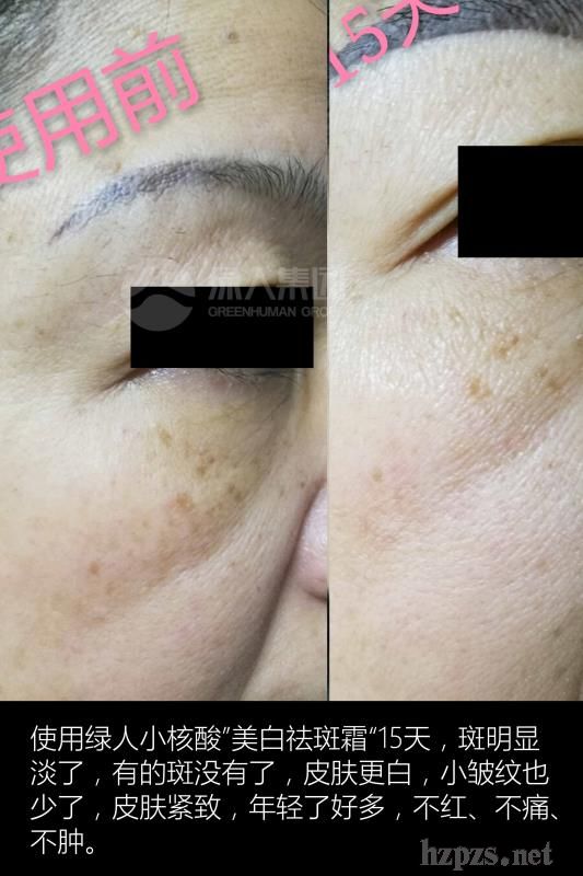 家用祛斑小妙招——輕松擁有無瑕肌膚，家用祛斑小妙招，打造無瑕肌膚的秘訣