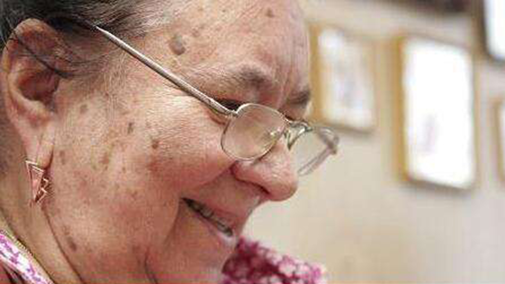 怎樣消除老年斑——全面解析有效方法，全面解析，消除老年斑的有效方法