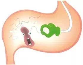 如何判斷自己是否患有胃炎——癥狀、原因及預(yù)防策略，如何判斷自己是否患有胃炎，癥狀、成因與預(yù)防方法全解析