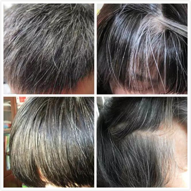 白發(fā)變黑發(fā)最快土法