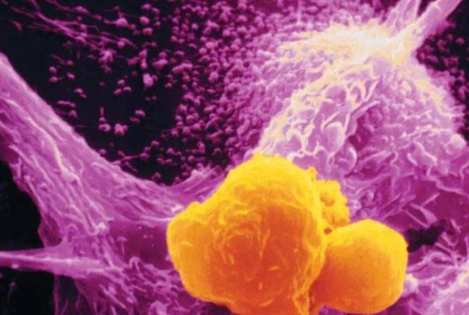 良性腫瘤的三大特征及其識(shí)別重要性，良性腫瘤的三大特征及其識(shí)別的重要性不可忽視