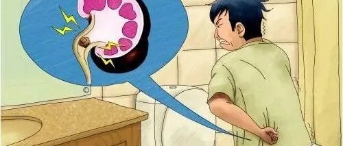 結(jié)石卡在輸尿管掉不下來怎么辦——專業(yè)指南與解決方案，結(jié)石卡在輸尿管的專業(yè)解決方案與指南，如何應(yīng)對不掉落的情況？